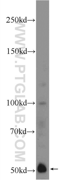 IFIT1 Rabbit anti-Human, Mouse, Rat, Polyclonal, Proteintech:Antibodies:Primary