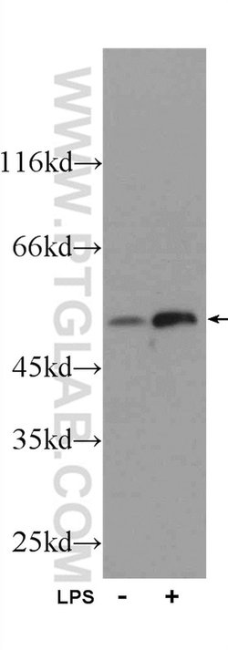 IFIT1 Rabbit anti-Human, Mouse, Rat, Polyclonal, Proteintech:Antibodies:Primary