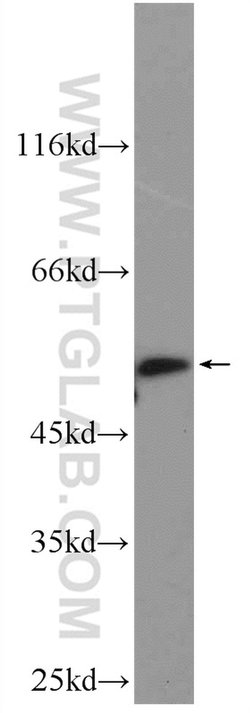 IFIT1 Rabbit anti-Human, Mouse, Rat, Polyclonal, Proteintech:Antibodies:Primary