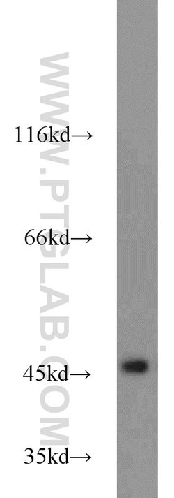 IDH2 Rabbit anti-Human, Mouse, Rat, Polyclonal, Proteintech 20 &mu;L; Unconjugated 