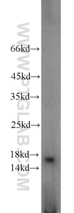 A2LD1 Rabbit anti-Human, Mouse, Rat, Polyclonal, Proteintech:Antibodies:Primary