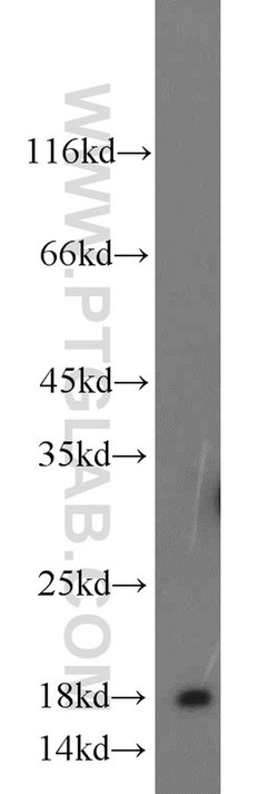 A2LD1 Rabbit anti-Human, Mouse, Rat, Polyclonal, Proteintech:Antibodies:Primary