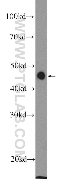 MTERFD1 Rabbit anti-Human, Mouse, Polyclonal, Proteintech 150 &mu;L; Unconjugated:Antibodies,
