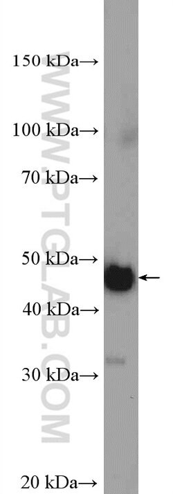 MTERFD1 Rabbit anti-Human, Mouse, Polyclonal, Proteintech 150 &mu;L; Unconjugated:Antibodies,