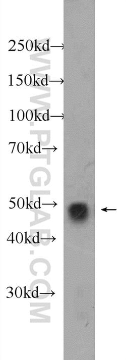TAZ Rabbit anti-Human, Polyclonal, Proteintech 20 &mu;L; Unconjugated:Anticuerpos