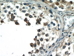 BCMO1 Rabbit anti-Human, Mouse, Polyclonal, Proteintech 150 &mu;L; Unconjugated:Antibodies,