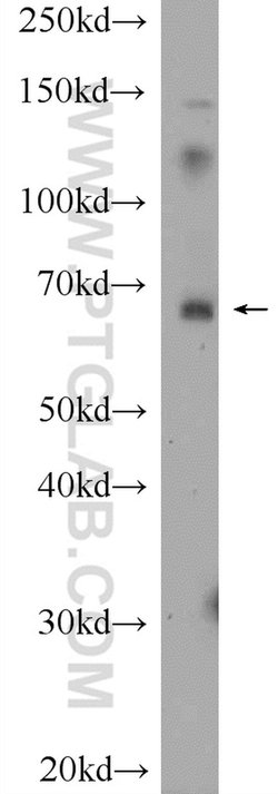 BCMO1 Rabbit anti-Human, Mouse, Polyclonal, Proteintech 150 &mu;L; Unconjugated:Antibodies,
