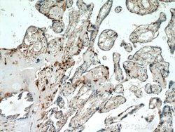 p57Kip2 Rabbit anti-Human, Polyclonal, Proteintech:Antibodies:Primary Antibodies