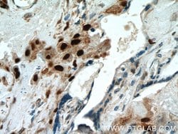 p57Kip2 Rabbit anti-Human, Polyclonal, Proteintech:Antibodies:Primary Antibodies