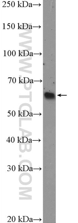 p57Kip2 Rabbit anti-Human, Polyclonal, Proteintech:Antibodies:Primary Antibodies
