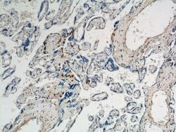 p57Kip2 Rabbit anti-Human, Polyclonal, Proteintech:Antibodies:Primary Antibodies