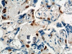 p57Kip2 Rabbit anti-Human, Polyclonal, Proteintech:Antibodies:Primary Antibodies