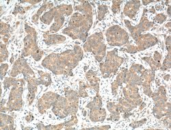 CAMLG Rabbit anti-Human, Mouse, Rat, Polyclonal, Proteintech 150 &mu;L;