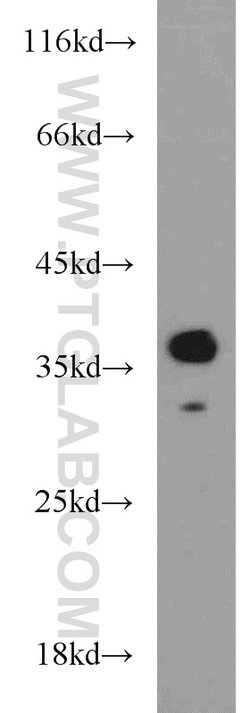 CAMLG Rabbit anti-Human, Mouse, Rat, Polyclonal, Proteintech 150 &mu;L;