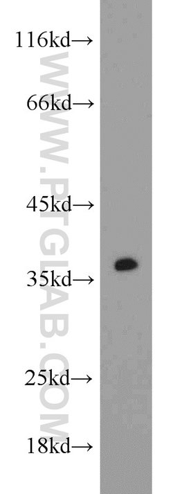 CAMLG Rabbit anti-Human, Mouse, Rat, Polyclonal, Proteintech 150 &mu;L;