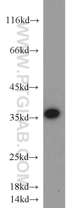CAMLG Rabbit anti-Human, Mouse, Rat, Polyclonal, Proteintech 150 &mu;L;