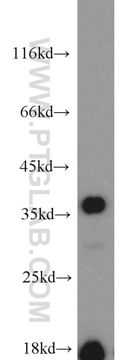 CAMLG Rabbit anti-Human, Mouse, Rat, Polyclonal, Proteintech 150 &mu;L;