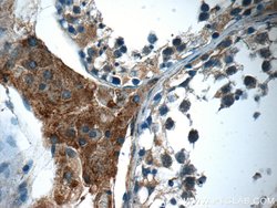 C16orf84 Rabbit anti-Human, Mouse, Polyclonal, Proteintech 150 &mu;L; Unconjugated:Antibodies,
