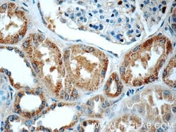 C16orf84 Rabbit anti-Human, Mouse, Polyclonal, Proteintech 150 &mu;L; Unconjugated:Antibodies,