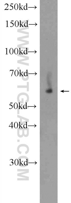 KDELC2 Rabbit anti-Human, Polyclonal, Proteintech 150 &mu;L | Buy Online | Proteintech | Fisher Scientific