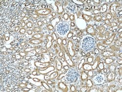 UPF1 Rabbit anti-Human, Mouse, Rat, Polyclonal, Proteintech:Antibodies:Primary