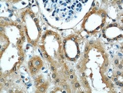 UPF1 Rabbit anti-Human, Mouse, Rat, Polyclonal, Proteintech:Antibodies:Primary