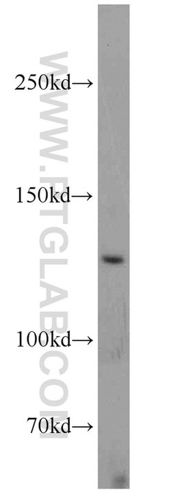 UPF1 Rabbit anti-Human, Mouse, Rat, Polyclonal, Proteintech:Antibodies:Primary