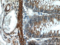 RANKL Rabbit anti-Human, Polyclonal, Proteintech:Antibodies:Primary Antibodies