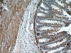 RANKL Rabbit anti-Human, Polyclonal, Proteintech:Antibodies:Primary Antibodies