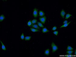 DOCK180 Rabbit anti-Human, Polyclonal, Proteintech 150 &mu;L; Unconjugated:Antibodies,