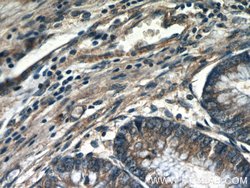 DOCK180 Rabbit anti-Human, Polyclonal, Proteintech 150 &mu;L; Unconjugated:Antibodies,