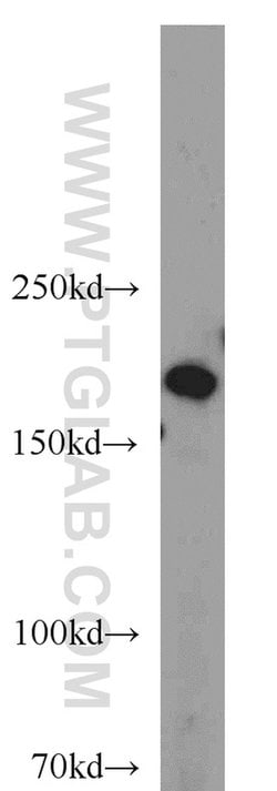 DOCK180 Rabbit anti-Human, Polyclonal, Proteintech 150 &mu;L; Unconjugated:Antibodies,