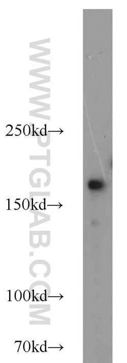 DOCK180 Rabbit anti-Human, Polyclonal, Proteintech 150 &mu;L; Unconjugated:Antibodies,