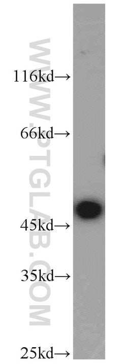 ADH7 Rabbit anti-Human, Polyclonal, Proteintech 150 &mu;L; Unconjugated:Antibodies,
