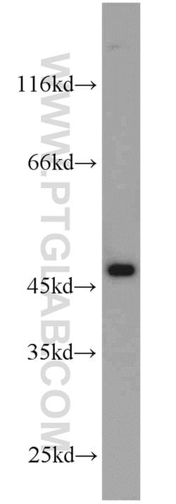 ADH7 Rabbit anti-Human, Polyclonal, Proteintech 150 &mu;L; Unconjugated:Antibodies,