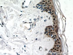 CBX6 Rabbit anti-Human, Polyclonal, Proteintech:Antibodies:Primary Antibodies