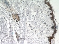 CBX6 Rabbit anti-Human, Polyclonal, Proteintech:Antibodies:Primary Antibodies