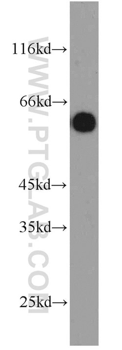 CBX6 Rabbit anti-Human, Polyclonal, Proteintech:Antibodies:Primary Antibodies
