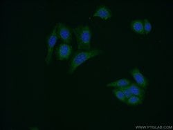 AMH Rabbit anti-Human, Polyclonal, Proteintech 150 &mu;L | Buy Online | Proteintech Group Inc | Fisher Scientific