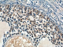 AMH Rabbit anti-Human, Polyclonal, Proteintech 150 &mu;L | Buy Online | Proteintech Group Inc | Fisher Scientific