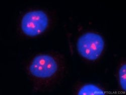 ESF1 Rabbit anti-Human, Mouse, Polyclonal, Proteintech:Antibodies:Primary