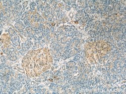 Ubiquilin 1 Rabbit anti-Human, Rat, Polyclonal, Proteintech 20 &mu;L; Unconjugated:Antibodies,