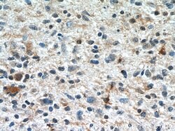 Ubiquilin 1 Rabbit anti-Human, Rat, Polyclonal, Proteintech 20 &mu;L; Unconjugated:Antibodies,