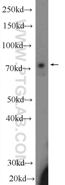 Ubiquilin 1 Rabbit anti-Human, Rat, Polyclonal, Proteintech 20 &mu;L; Unconjugated:Antibodies,