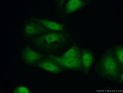 HOXD13 Rabbit anti-Human, Polyclonal, Proteintech:Antibodies:Primary Antibodies