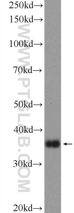 HOXD13 Rabbit anti-Human, Polyclonal, Proteintech:Antibodies:Primary Antibodies
