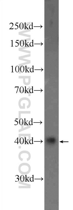 HOXD13 Rabbit anti-Human, Polyclonal, Proteintech:Antibodies:Primary Antibodies