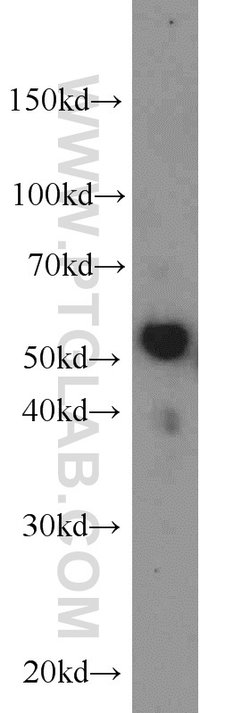 LBP Rabbit anti-Human, Mouse, Rat, Polyclonal, Proteintech:Antibodies:Primary