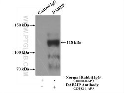 DAB2IP Rabbit anti-Human, Mouse, Polyclonal, Proteintech:Antibodies:Primary
