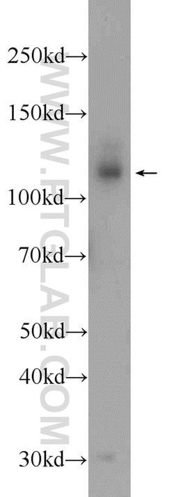 DAB2IP Rabbit anti-Human, Mouse, Polyclonal, Proteintech:Antibodies:Primary